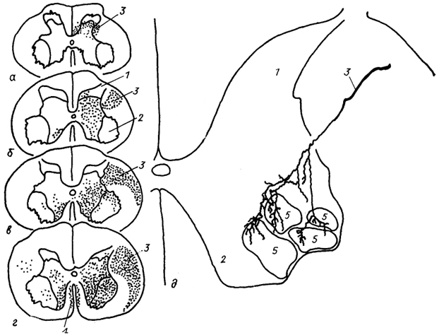  Рис. 25. Окончание кортико-спинального тракта в шейных сегментах спинного мозга опоссума (а), кошки (б), макаки (в), шимпанзе (г) и характер ветвления одного волокна в моторных ядрах мозга макаки (д) (Shinoda е. а., 1979; Kuypers, 1981). /, 2 -- задние (1) и передние (2) рога спинного мозга; 3, 4 - латеральный (3) и передний (4) кортико-апинальные тракты; 5 - моторные ядра.